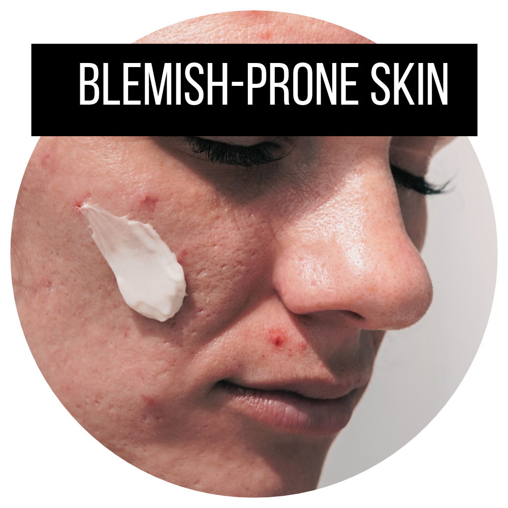 Blemish-Prone Skin