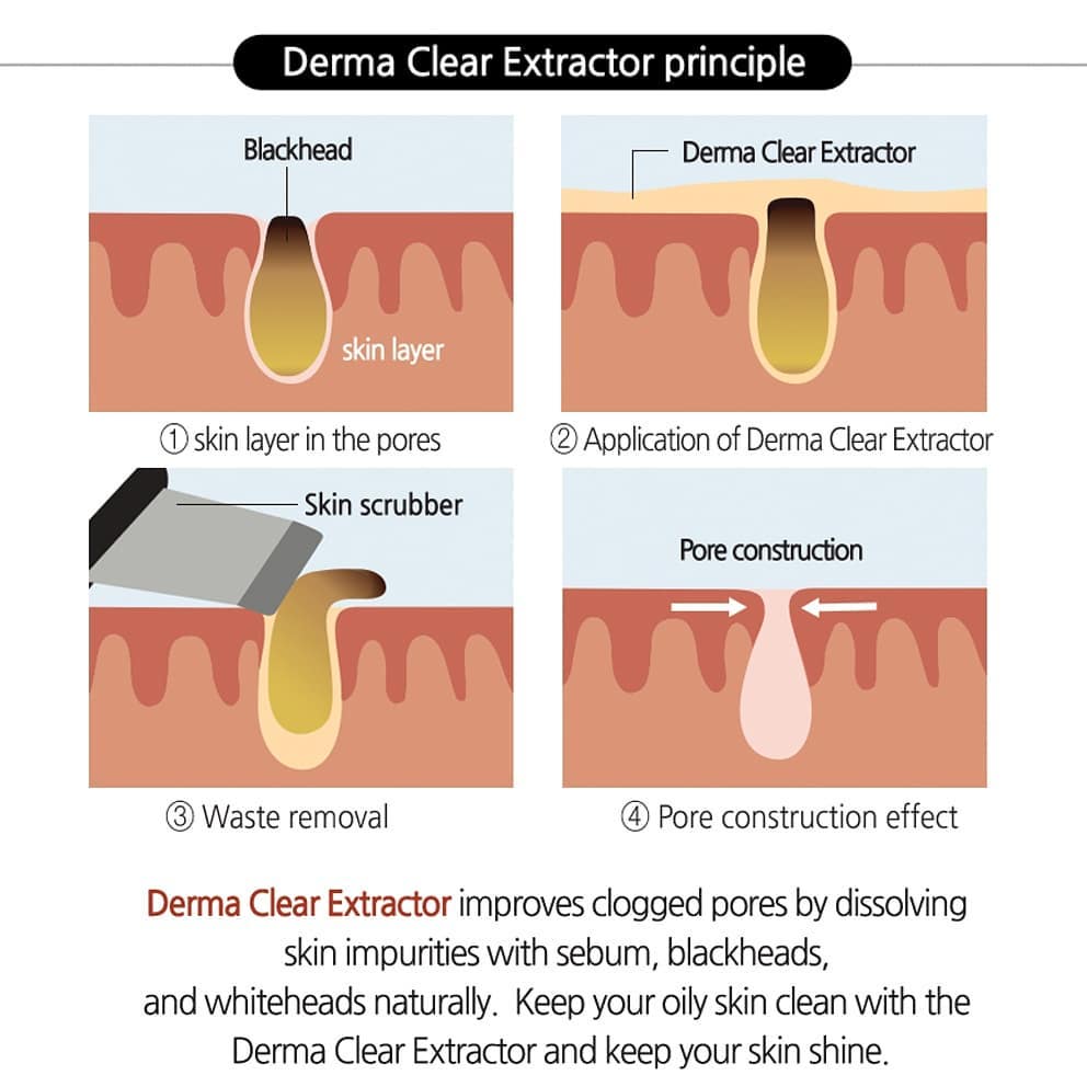 Derma Clear Extractor Blackhead & Whitehead Removal 33.81fl oz